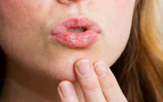 Сухость во рту — причины какой болезни? Какие симптомы могут ее сопровождать?