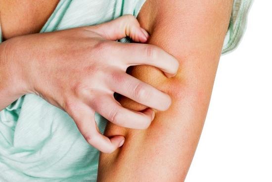 Симптомы нейродермита у взрослых