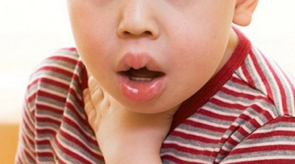 Как оказать первую помощь при отеке Квинке?