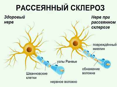 Картинка 2