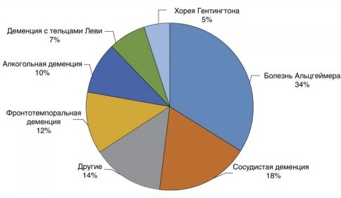 Array