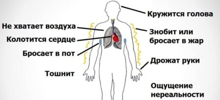 Array